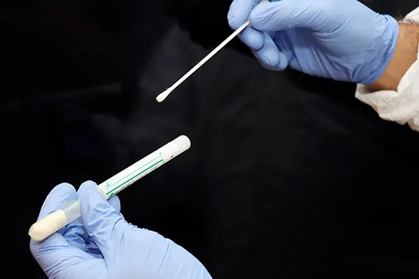 Air Sampling vs Surface Sampling for Mold